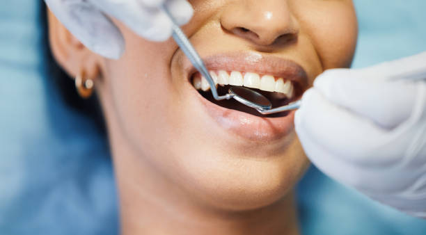Professional Emergency Dental Service in MT